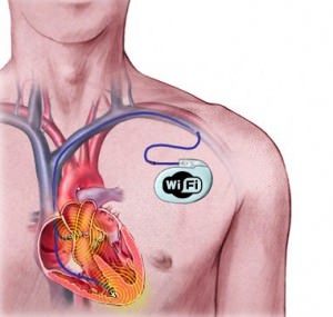 Wi-Fi Pacemaker